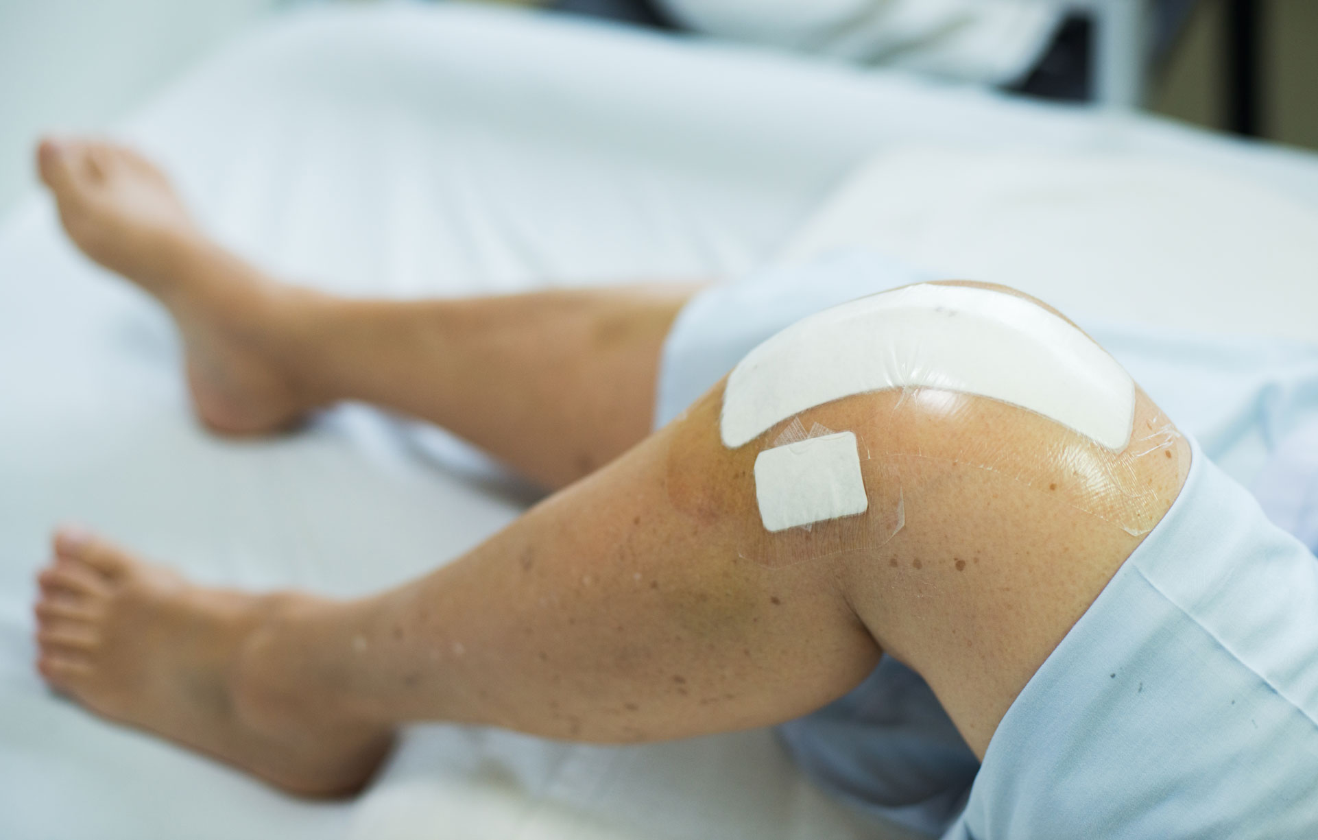 Lire la suite à propos de l’article 400.000 € suite à une complication de prothèse de genou